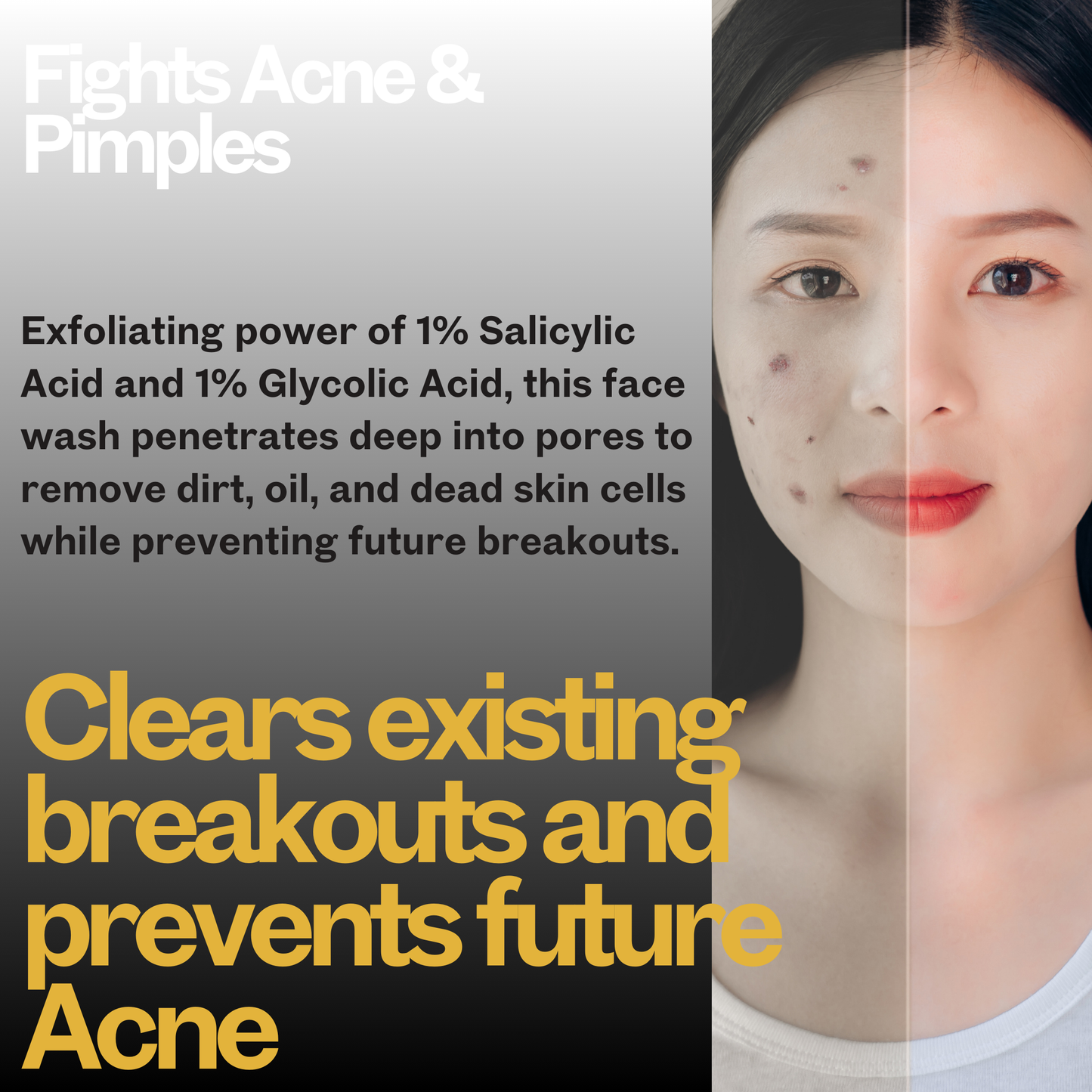 Salicylic Acid Foaming Face Wash with 1% Salicylic & 1% Glycolic Acid (AHA BHA) for Acne-Prone & Oily Skin that Controls Acne or Pimples | 100 ML