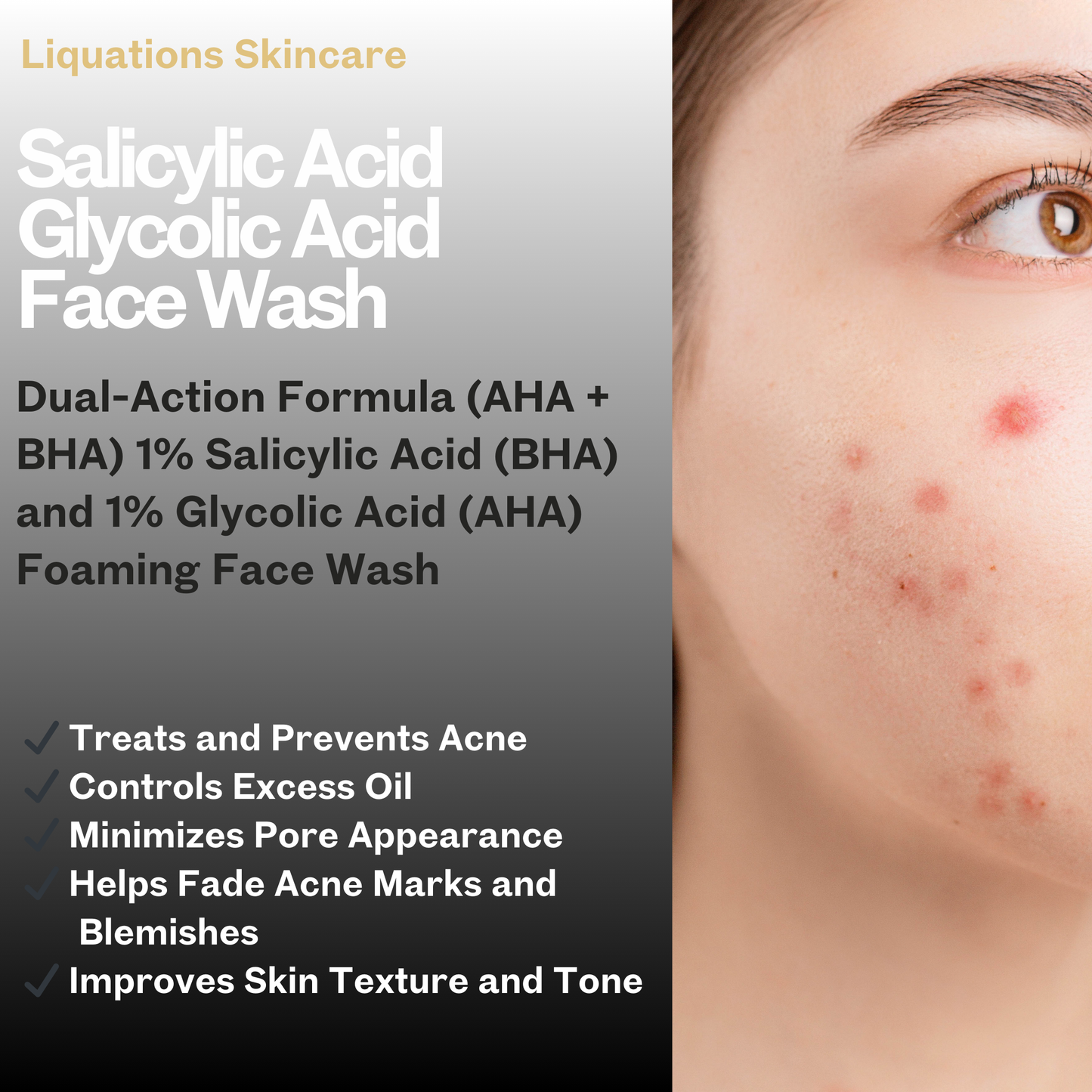 Salicylic Acid Foaming Face Wash with 1% Salicylic & 1% Glycolic Acid (AHA BHA) for Acne-Prone & Oily Skin that Controls Acne or Pimples | 100 ML